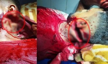 मामूली विवाद को लेकर हिंसक झड़प, दो गंभीर