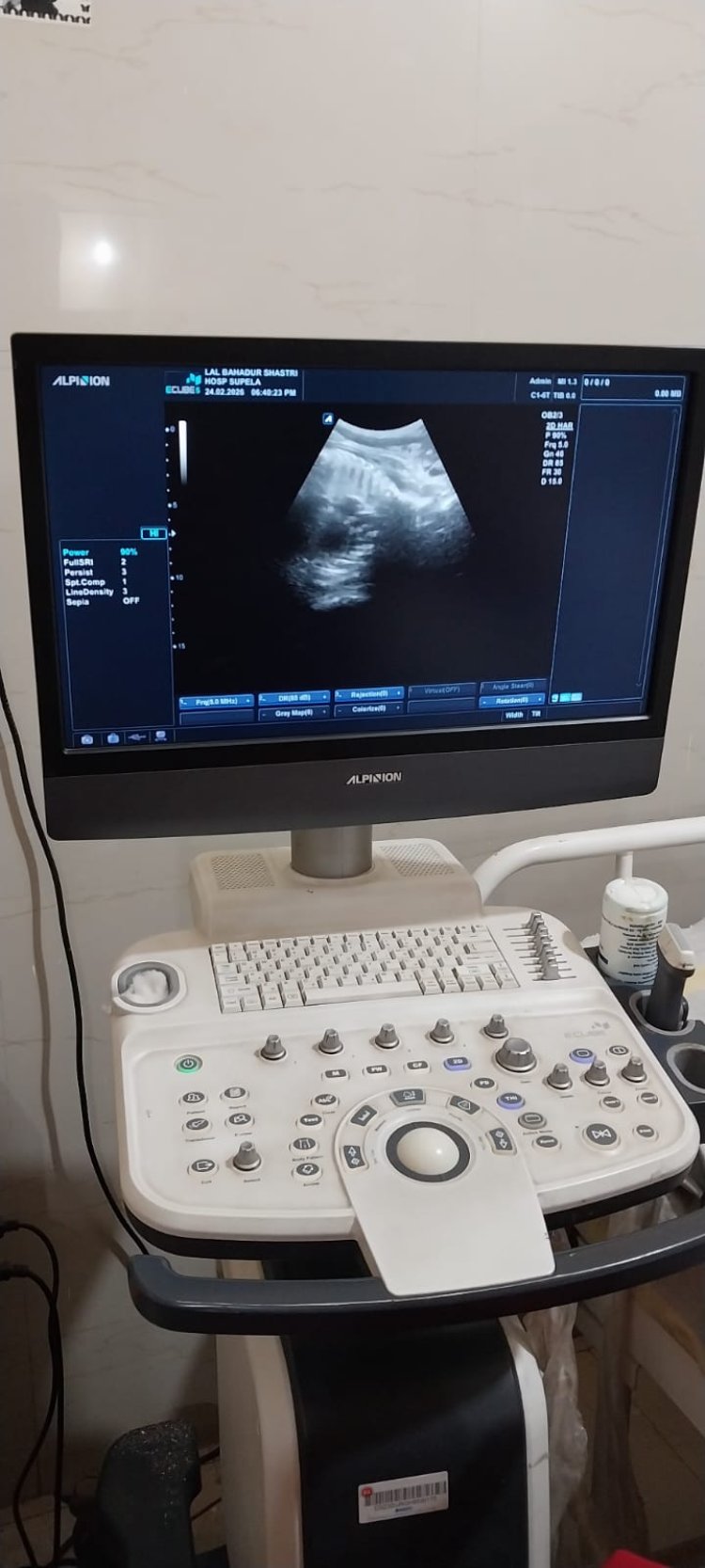 लाल बहादुर शास्त्री सिविल अस्पताल सुपेला में सोनोग्राफी सुविधा की सौगात