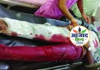 भिलाई नेहरू नगर चौक पर चाकूबाजी, इलाज के दौरान युवक की मौत