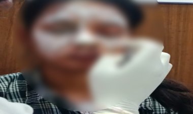 युवती पर एसिड अटैक का 8 घंटे में खुलासा, कथित प्रेमी समेत दो आरोपी गिरफ्तार