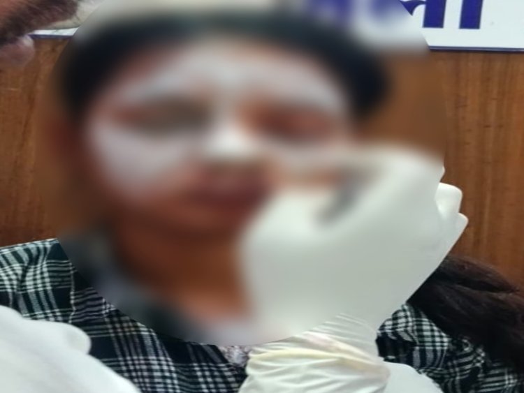 युवती पर एसिड अटैक का 8 घंटे में खुलासा, कथित प्रेमी समेत दो आरोपी गिरफ्तार