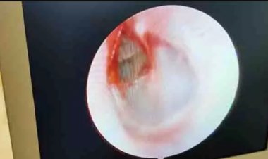 टीचर ने ऐसा मारा तमाचा की फट गया बच्चे के कान का पर्दा, अब स्कूल प्रबंधन उठाएगा इलाज का सारा खर्च