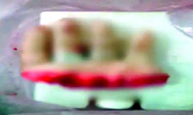 पत्नी की हाथ के पंजे को काटकर अलग करने वाले पति गिरफ्तार