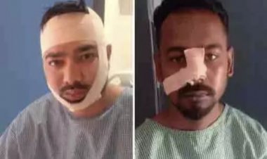 भाजयुमों अध्यक्ष पर जानलेवा हमला करने वाले 3 आरोपी गिरफ्तार