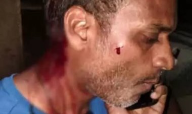 पार्षद पति पर लोहे की रॉड से हमला, सिर पर लगे 11 टांके