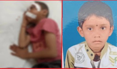 गंभीर हालत में मिला स्कूल के लिए निकला बालक, चोट के कई निशान, एक आंख फोड़ गोंद डालने का प्रयास, हालात नाजुक