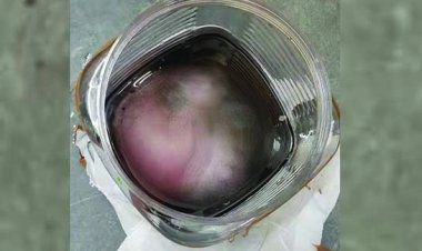 एयरपोर्ट में स्केनिंग के दौरान डिब्बे में मिला नवजात का शव