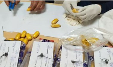 इस महिला के पेट से निकाला गया साढ़े 5 करोड़ का कोकीन, जांच के दौरान एयरपोर्ट में पकड़ी गई