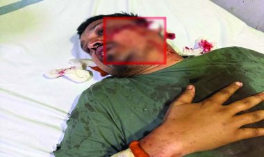 रायपुर सेंट्रल जेल में गैंगवार: भूपेश बघेल के करीबी नेता पर जानलेवा हमला, कांग्रेस में गुटबाजी उजागर