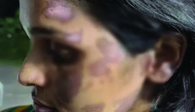 पति बना हैवान! महिला को चिमटे से जलाया, गर्म पानी में डुबोया, चाणक्य अकैडमी का संचालक गिरफ्तार