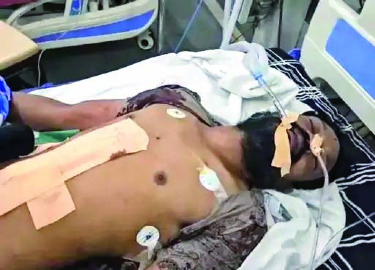 शराबी ने पत्नी से विवाद के बाद खुद को मारा चाकू, हालत गंभीर