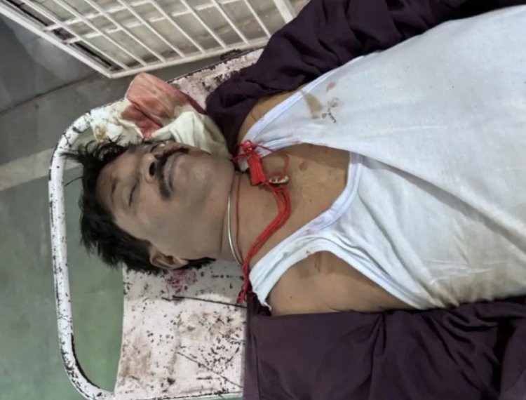 भिलाई में बड़ा हादसा, रेड सिग्नल पर खड़ी बाइकों को तेज रफ्तार कार ने रौंदा, 2 की मौत, एक युवक ICU में भर्ती, कार चालक पुलिस की गिरफ्त में