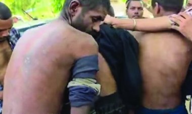 12 बंधुआ मजदूर मुक्त, 3 की मौत का आरोप, पिटबुल के डर और थर्ड डिग्री टॉर्चर से सालों तक कैद में रहे मजदूर