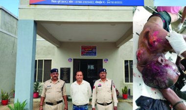विवाद के बाद युवक को काफी दूर तक घसीटता रहा कार चालक, पुलिस ने कार समेत आरोपी को पकड़ा