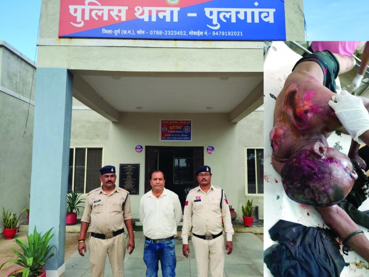 विवाद के बाद युवक को काफी दूर तक घसीटता रहा कार चालक, पुलिस ने कार समेत आरोपी को पकड़ा
